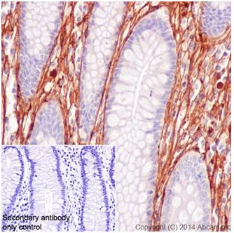 Immunohistochemistry (Formalin/PFA-fixed paraffin-embedded sections) - Anti-Collagen VI antibody [EPR17077] - C-terminal (AB199720)