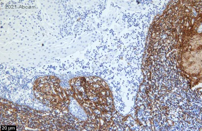 Immunohistochemistry (Formalin/PFA-fixed paraffin-embedded sections) - Anti-Collagen VI antibody [EPR17077] - C-terminal (AB199720)