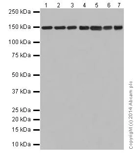 Western blot - Anti-Collagen VI antibody [EPR17077] - C-terminal (AB199720)