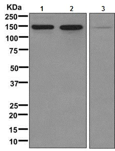 Western blot - Anti-Collagen VI antibody [EPR7888(N)] (AB172606)