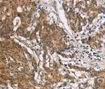 Immunohistochemistry (Formalin/PFA-fixed paraffin-embedded sections) - Anti-Collagen VII antibody (AB198899)
