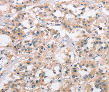 Immunohistochemistry (Formalin/PFA-fixed paraffin-embedded sections) - Anti-Collagen VII antibody (AB198899)
