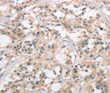 Immunohistochemistry (Formalin/PFA-fixed paraffin-embedded sections) - Anti-Collagen VII antibody (AB198899)