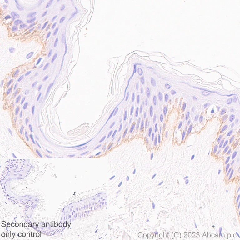 Immunohistochemistry (Formalin/PFA-fixed paraffin-embedded sections) - Anti-Collagen VII antibody [EPR27012-157] (AB309143)