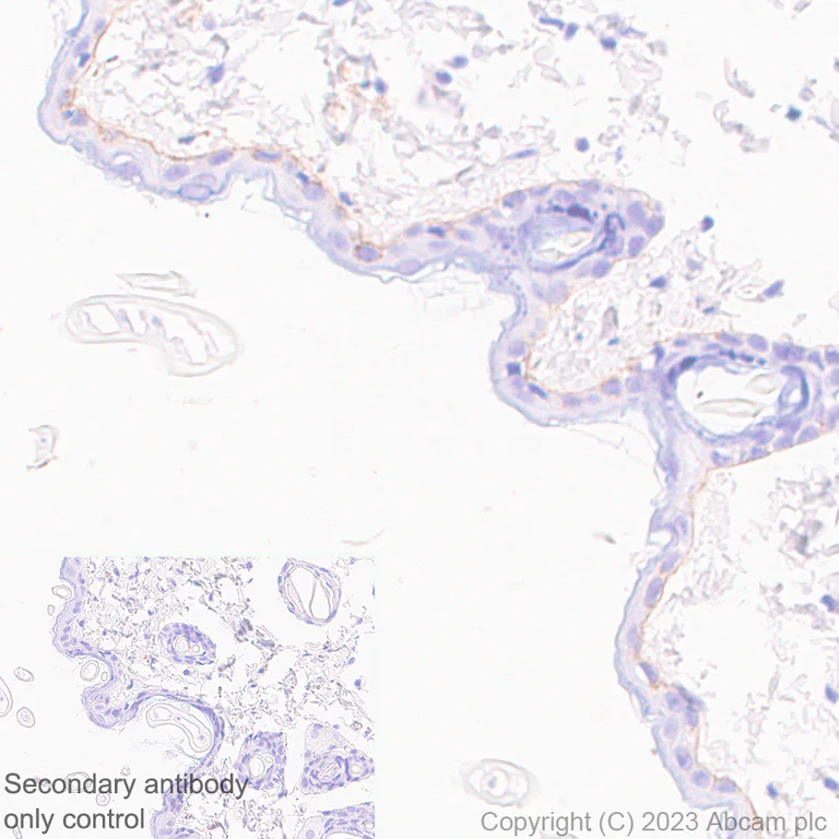 Immunohistochemistry (Formalin/PFA-fixed paraffin-embedded sections) - Anti-Collagen VII antibody [EPR27012-157] (AB309143)