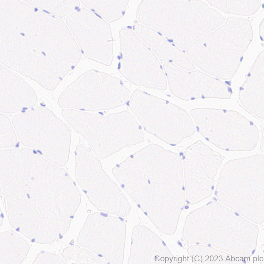 Immunohistochemistry (Formalin/PFA-fixed paraffin-embedded sections) - Anti-Collagen VII antibody [EPR27012-157] (AB309143)
