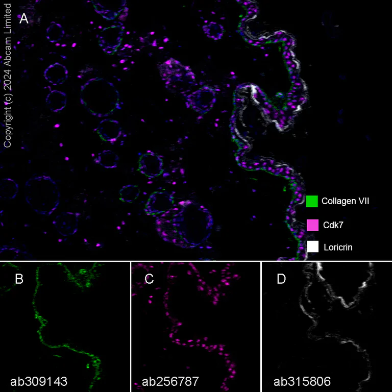 Multiplex immunohistochemistry - Anti-Collagen VII antibody [EPR27012-157] (AB309143)