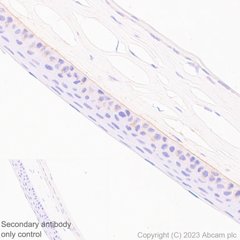 Immunohistochemistry (Formalin/PFA-fixed paraffin-embedded sections) - Anti-Collagen VII antibody [EPR27012-157] - BSA and Azide free (AB309144)