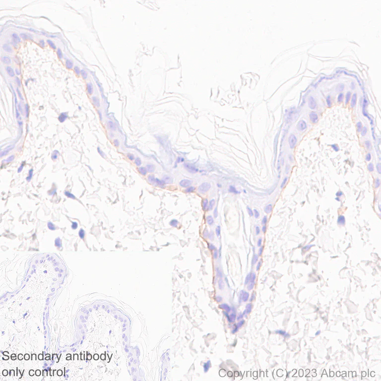 Immunohistochemistry (Formalin/PFA-fixed paraffin-embedded sections) - Anti-Collagen VII antibody [EPR27012-157] - BSA and Azide free (AB309144)