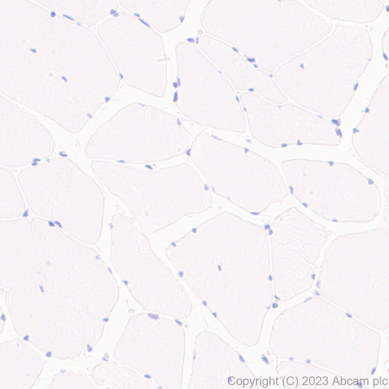 Immunohistochemistry (Formalin/PFA-fixed paraffin-embedded sections) - Anti-Collagen VII antibody [EPR27012-157] - BSA and Azide free (AB309144)
