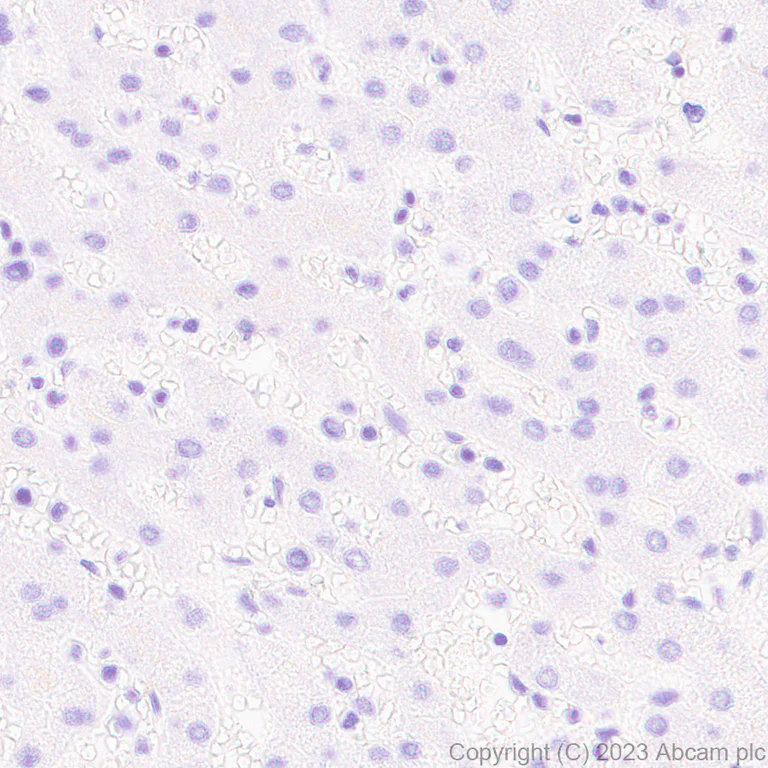 Immunohistochemistry (Formalin/PFA-fixed paraffin-embedded sections) - Anti-Collagen VII antibody [EPR27012-157] - BSA and Azide free (AB309144)