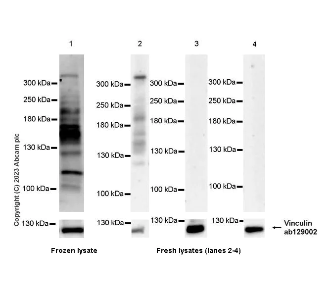 Western blot - Anti-Collagen VII antibody [EPR27012-157] - BSA and Azide free (AB309144)