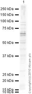 Western blot - Anti-Collagen X antibody (AB58632)