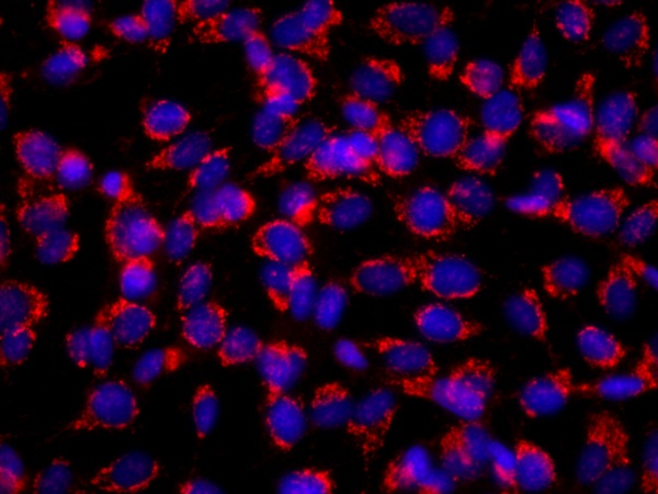 Immunocytochemistry/ Immunofluorescence - Anti-Collagen X antibody [COL-10] (AB49945), expandable thumbnail