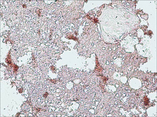Immunohistochemistry (Formalin/PFA-fixed paraffin-embedded sections) - Anti-Collagen X antibody [COL-10] (AB49945), expandable thumbnail