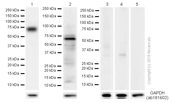 Western blot - Anti-Collagen X antibody [EPR13044] (AB182563)