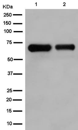 Western blot - Anti-Collagen X antibody [EPR13044] (AB182563)