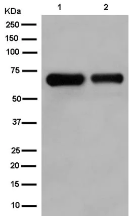 Western blot - Anti-Collagen X antibody [EPR13044] - BSA and Azide free (AB232661)