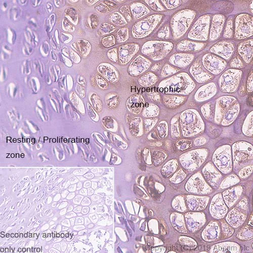 Immunohistochemistry (Formalin/PFA-fixed paraffin-embedded sections) - Anti-Collagen X antibody [EPR22920-211] - BSA and Azide free (AB264571)