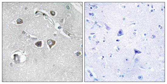 Immunohistochemistry (Formalin/PFA-fixed paraffin-embedded sections) - Anti-Collagen XI alpha 2/COL11A2 antibody (AB196613)