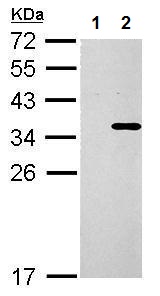 Western blot - Anti-Collagen XI alpha 2/COL11A2 antibody - Membrane Vesicle Marker (AB227945)