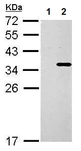 Western blot - Anti-Collagen XI alpha 2/COL11A2 antibody - Membrane Vesicle Marker (AB227945)
