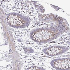 Immunohistochemistry (Formalin/PFA-fixed paraffin-embedded sections) - Anti-Collagen XVII antibody (AB204056)