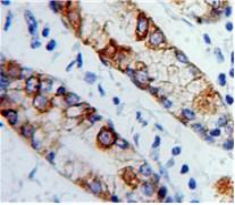 Immunohistochemistry (Formalin/PFA-fixed paraffin-embedded sections) - Anti-Collagen XVII antibody (AB231939), expandable thumbnail
