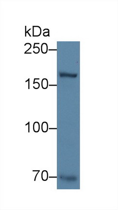 Western blot - Anti-Collagen XVII antibody (AB231939), expandable thumbnail