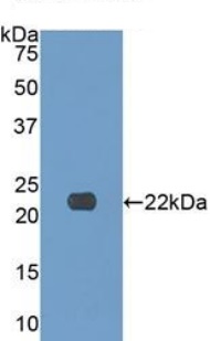 Western blot - Anti-Collagen XVII antibody (AB231939), expandable thumbnail