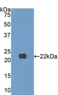 Western blot - Anti-Collagen XVII antibody (AB231939)