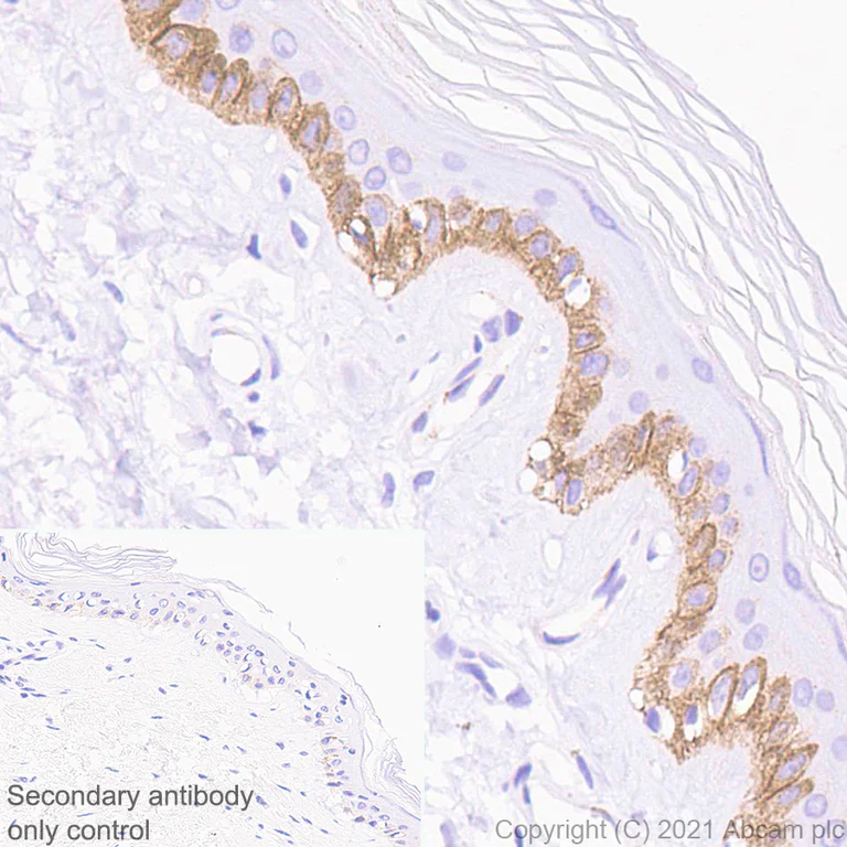 Immunohistochemistry (Formalin/PFA-fixed paraffin-embedded sections) - Anti-Collagen XVII antibody [EPR14758] (AB186415)