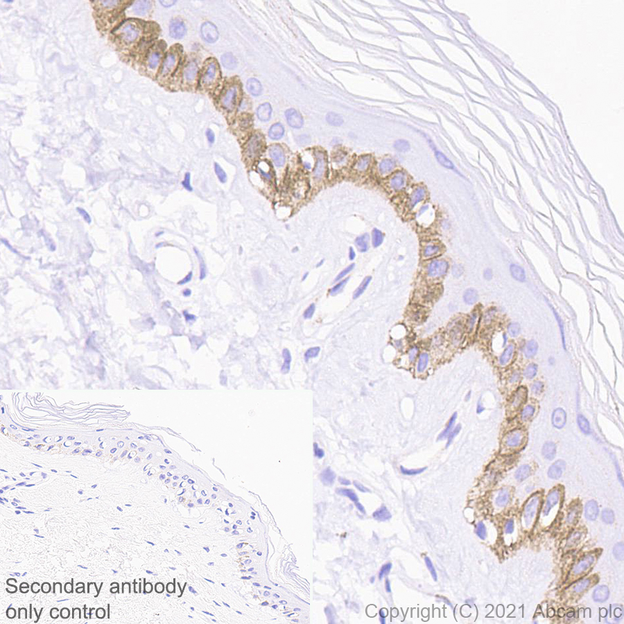 Immunohistochemistry (Formalin/PFA-fixed paraffin-embedded sections) - Anti-Collagen XVII antibody [EPR14758] - BSA and Azide free (AB239005)