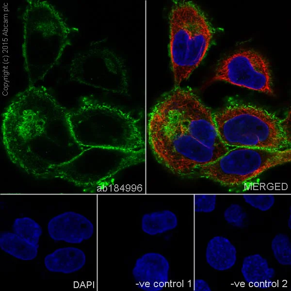 Immunocytochemistry/ Immunofluorescence - Anti-Collagen XVII antibody [EPR18614] (AB184996)
