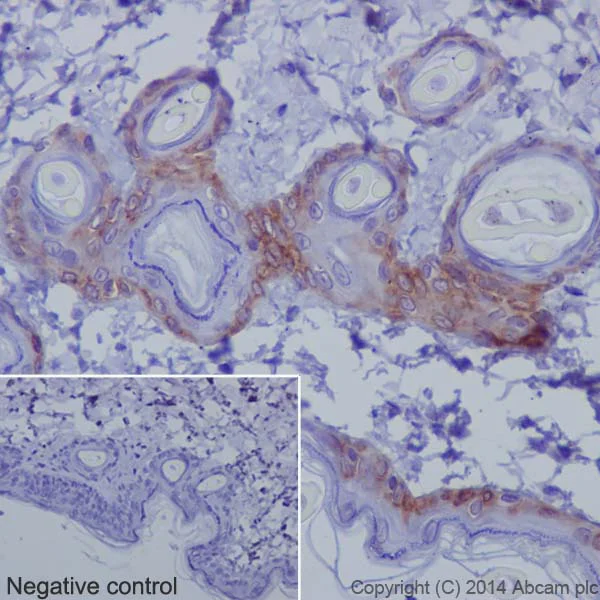 Immunohistochemistry (Formalin/PFA-fixed paraffin-embedded sections) - Anti-Collagen XVII antibody [EPR18614] (AB184996)