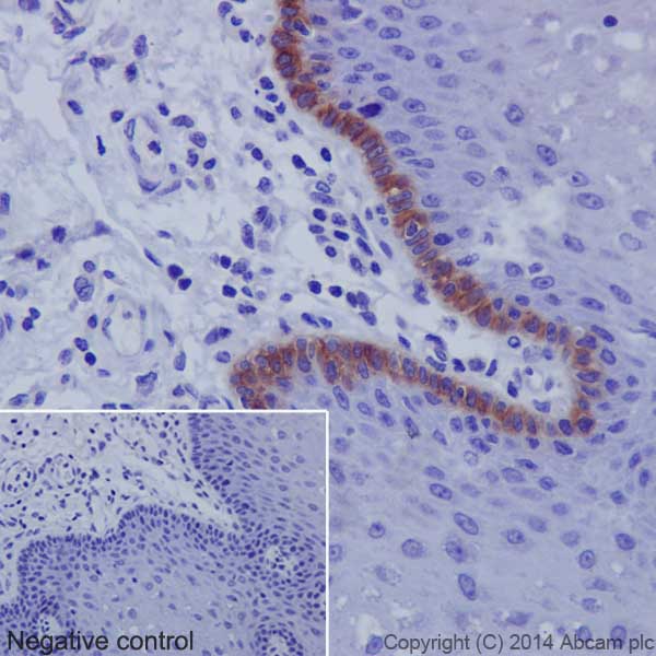 Anti-Collagen XVII antibody [EPR18614]