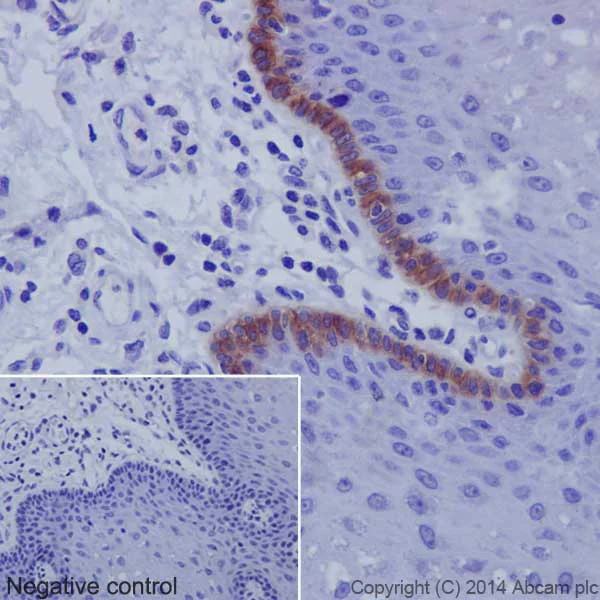 Immunohistochemistry (Formalin/PFA-fixed paraffin-embedded sections) - Anti-Collagen XVII antibody [EPR18614] (AB184996)