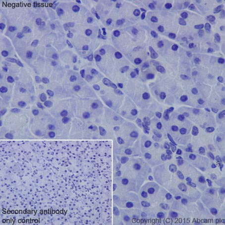 Immunohistochemistry (Formalin/PFA-fixed paraffin-embedded sections) - Anti-Collagen XVII antibody [EPR18614] (AB184996)