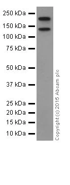 Western blot - Anti-Collagen XVII antibody [EPR18614] (AB184996)