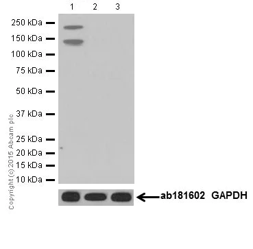 Western blot - Anti-Collagen XVII antibody [EPR18614] (AB184996)
