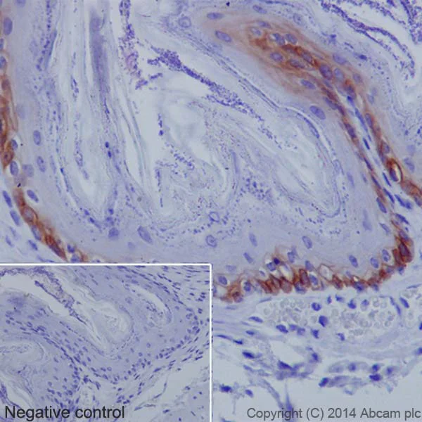 Immunohistochemistry (Formalin/PFA-fixed paraffin-embedded sections) - Anti-Collagen XVII antibody [EPR18614] - BSA and Azide free (AB271950)