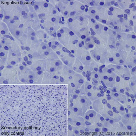 Immunohistochemistry (Formalin/PFA-fixed paraffin-embedded sections) - Anti-Collagen XVII antibody [EPR18614] - BSA and Azide free (AB271950)