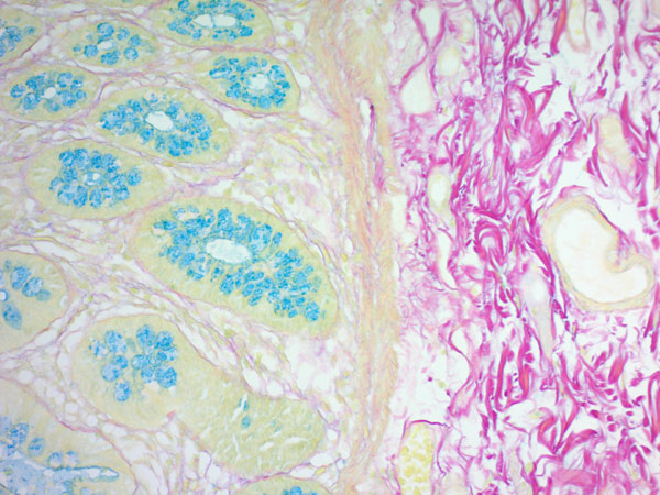 Immunohistochemistry (Formalin/PFA-fixed paraffin-embedded sections) - Colloidal Iron Stain Kit (Mucin Stain) (AB150664), expandable thumbnail
