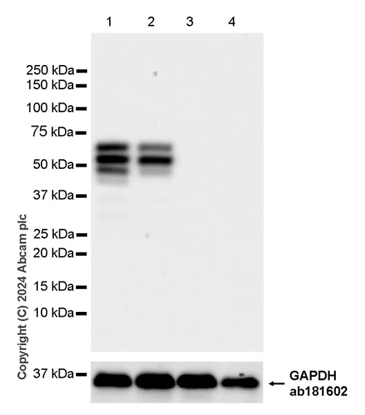 Western blot - Anti-Collybistin antibody [EPR28024-32] (AB316963)
