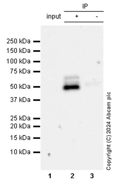 Immunoprecipitation - Anti-Collybistin antibody [EPR28024-32] - BSA and Azide free (AB316964), expandable thumbnail