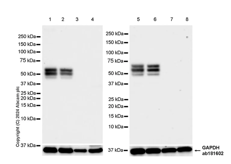 Western blot - Anti-Collybistin antibody [EPR28024-32] - BSA and Azide free (AB316964)