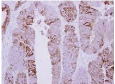 Immunohistochemistry (Formalin/PFA-fixed paraffin-embedded sections) - Anti-COLQ antibody (AB127048)
