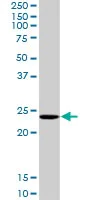 Western blot - Anti-COMMD1/MURR1 antibody (AB102794)
