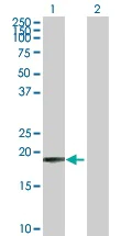 Western blot - Anti-COMMD1/MURR1 antibody (AB102794)