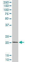 Western blot - Anti-COMMD1/MURR1 antibody (AB102794)